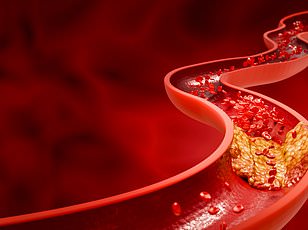 11 Extra Minutes of Sleep May Cut Heart Attack Risk as Much as Medication, Study Shows