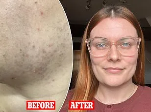 Metformin May Mimic Exercise Benefits, Boosting Heart Health and Weight Control in Sedentary Individuals