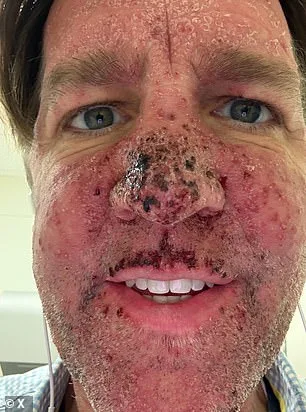 Ben Sasse's Unprecedented Survival Against Stage 4 Pancreatic Cancer: The Price of Experimental Treatment