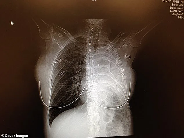 The Worn Bomber Jacket That Became a Lifeline in Heather Von St James' Cancer Battle