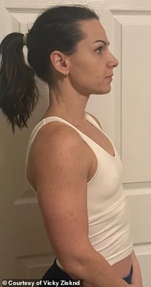 Revolutionizing Breast Augmentation: A Minimally Invasive Breakthrough in Plastic Surgery