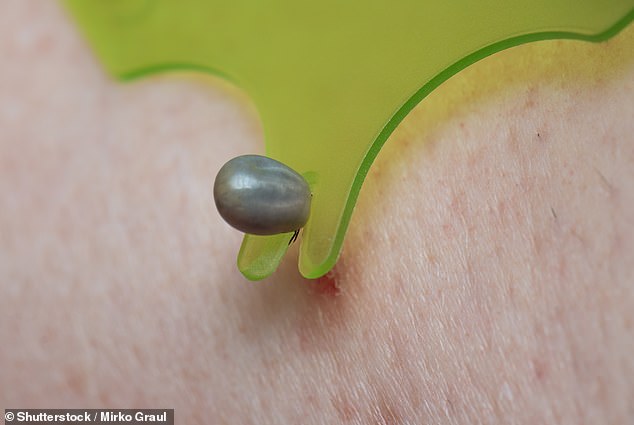 Northeast Emerges as Tick-Borne Illness Epicenter With Surge in Hospitalizations