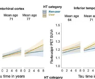 Later-Life HRT May Increase Risk of Alzheimer's in Women