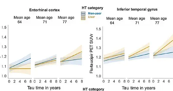 Later-Life HRT May Increase Risk of Alzheimer's in Women