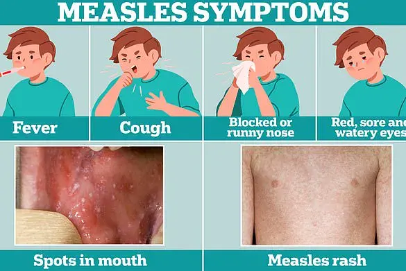 Measles Case in Pennsylvania Raises Outbreak Concerns