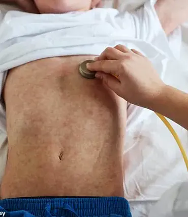 Measles Outbreak in the US: Addressing Vaccine Hesitancy for Public Wellbeing