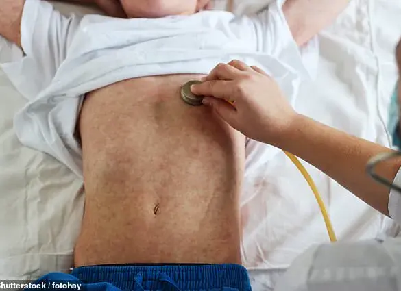 Measles Outbreak in the US: Addressing Vaccine Hesitancy for Public Wellbeing