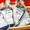 Study Reveals Higher Stomach Cancer Risk for Non-O Blood Types