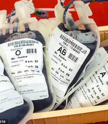 Study Reveals Higher Stomach Cancer Risk for Non-O Blood Types
