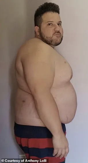 The 'Dad Bod' Makeover: A Rising Trend in Plastic Surgery