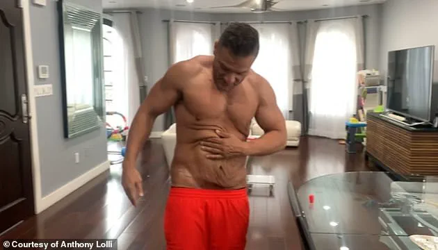 The 'Dad Bod' Makeover: A Rising Trend in Plastic Surgery