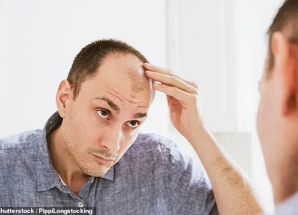 The Dark Side of Energy Drinks: Are They Linked to Hair Loss and Anxiety in Men?