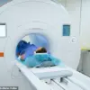 The Hidden Danger of Hair Extensions During MRI Scans