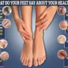 The Irish Pinky Toe: Unraveling a Little-Known Foot Condition