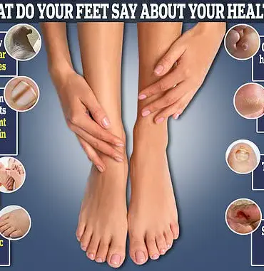 The Irish Pinky Toe: Unraveling a Little-Known Foot Condition