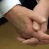 Trump Hand Mark: Medical Expert Explains