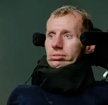 Warning Signs: Difficulty Swallowing and Drooling Indicate Potential Risk for Motor Neurone Disease