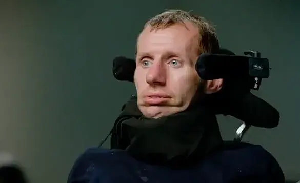 Warning Signs: Difficulty Swallowing and Drooling Indicate Potential Risk for Motor Neurone Disease