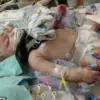 Baby Suffers Severe Brain Injury After Fall: Urgent Surgery Saves Life