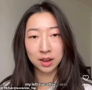 Beauty Influencer Goes Blind in One Eye After Skincare Procedure in South Korea