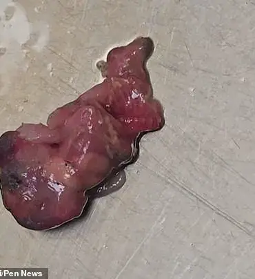 Beauty Therapist Finds Suspected Dead Rodent Embryo in Tesco Lettuce