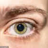 Blurred Vision and Seeing Spots Linked to Early-Onset Dementia Risk