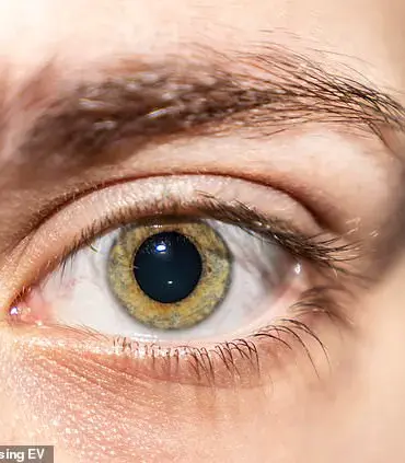 Blurred Vision and Seeing Spots Linked to Early-Onset Dementia Risk