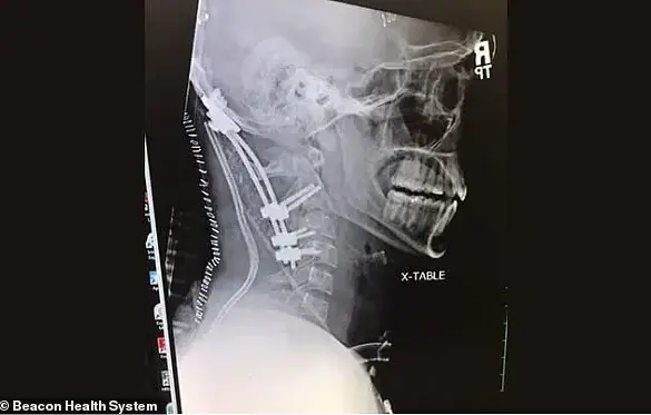 Farmer's Near Miss with 'Internal Decapitation' Spotlights Medical Marvels