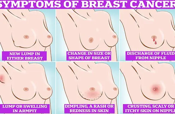 NHS Cancer Chief Urges Public to Watch for Subtle Signs like Bruising and Bloating