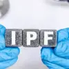 NHS Cancer Drug Shows Promise for Treating Idiopathic Pulmonary Fibrosis