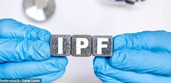 NHS Cancer Drug Shows Promise for Treating Idiopathic Pulmonary Fibrosis