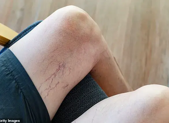 Top Doctor Reveals Unlikely Skin Signs of Liver Toxicity
