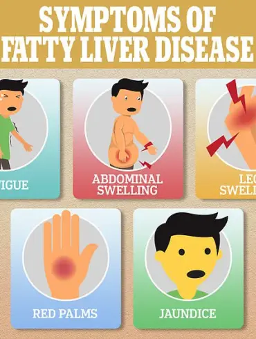 Hidden Health Crisis: Groundbreaking Study Reveals Link Between Fatty Liver Disease and Early-Onset Colon Cancer, Prompting Expert Advisories