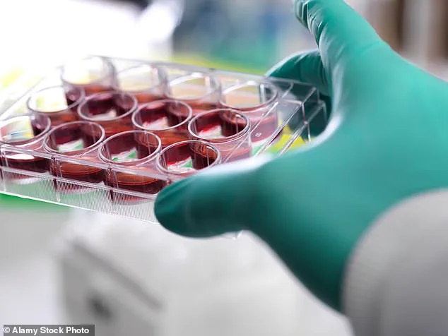 Hollywood Star Achieves MS Remission with Innovative Treatment