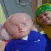Misdiagnosis and Delayed Treatment in Normal Pressure Hydrocephalus: The Importance of Early Detection