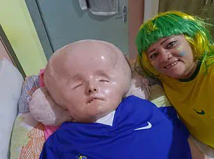 Misdiagnosis and Delayed Treatment in Normal Pressure Hydrocephalus: The Importance of Early Detection