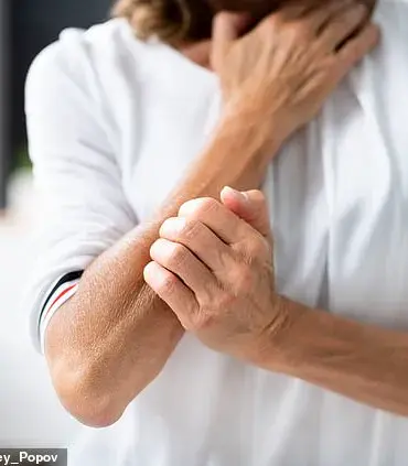 New Research Links Abdominal Fat to Psoriasis, Shifting Focus from General Obesity