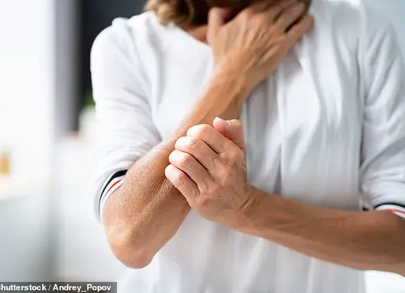 New Research Links Abdominal Fat to Psoriasis, Shifting Focus from General Obesity