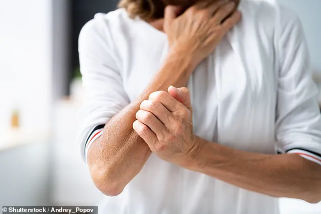 New Research Links Abdominal Fat to Psoriasis, Shifting Focus from General Obesity