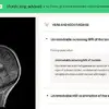 Revolutionizing Cancer Detection: AI-Powered Lunch-Hour MRI Scans Expand to the UK