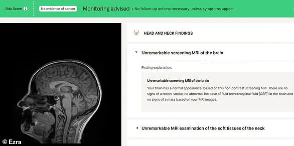 Revolutionizing Cancer Detection: AI-Powered Lunch-Hour MRI Scans Expand to the UK