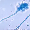 UK Health Officials Warn of 'Serious Threat to Humanity' as Deadly Fungus C. auris Spreads Globally, Prompting Calls for Enhanced Infection Control Measures