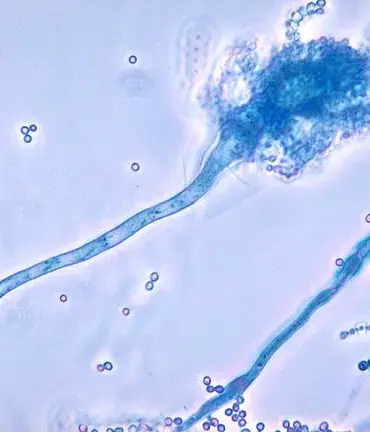 UK Health Officials Warn of 'Serious Threat to Humanity' as Deadly Fungus C. auris Spreads Globally, Prompting Calls for Enhanced Infection Control Measures