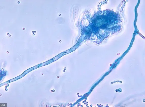UK Health Officials Warn of 'Serious Threat to Humanity' as Deadly Fungus C. auris Spreads Globally, Prompting Calls for Enhanced Infection Control Measures