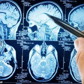 Breakthrough Study Reveals Urgent Link Between Carb Reduction and Alzheimer's Prevention