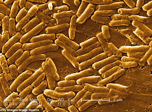 FDA Issues Urgent Recall of Pre-Made Salads Over Salmonella Contamination Risk