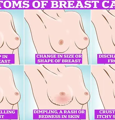 Potential Expansion of NHS Breast Cancer Screening to Include Women in Their 30s