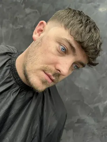 Rising Trend: Young Men Turn to Hair Systems as Alternative to Traditional Hair Loss Solutions