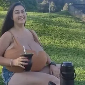 Breaking: Brazilian Woman with Rare Gigantomastia Shares Her Journey as Medical Community Rises to Aid