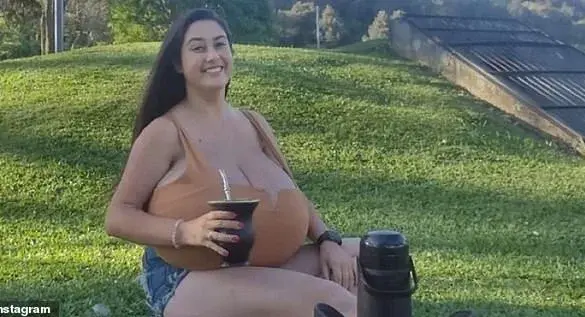 Breaking: Brazilian Woman with Rare Gigantomastia Shares Her Journey as Medical Community Rises to Aid